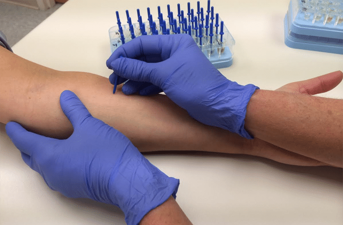 desensibilisation allergie